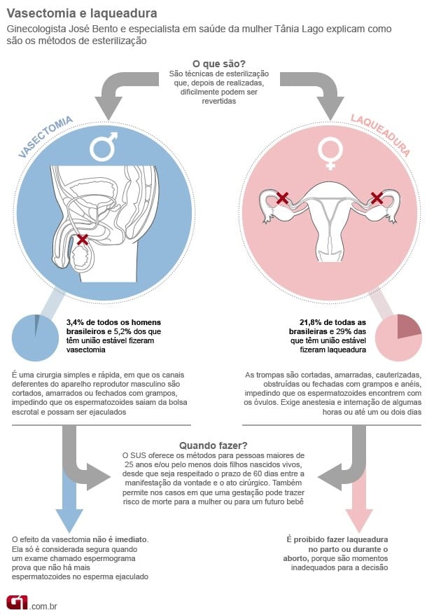 Como Fazer Laqueadura e Vasectomia pelo SUS - Tire suas dúvidas 1 Vasectomia e Laqueadura