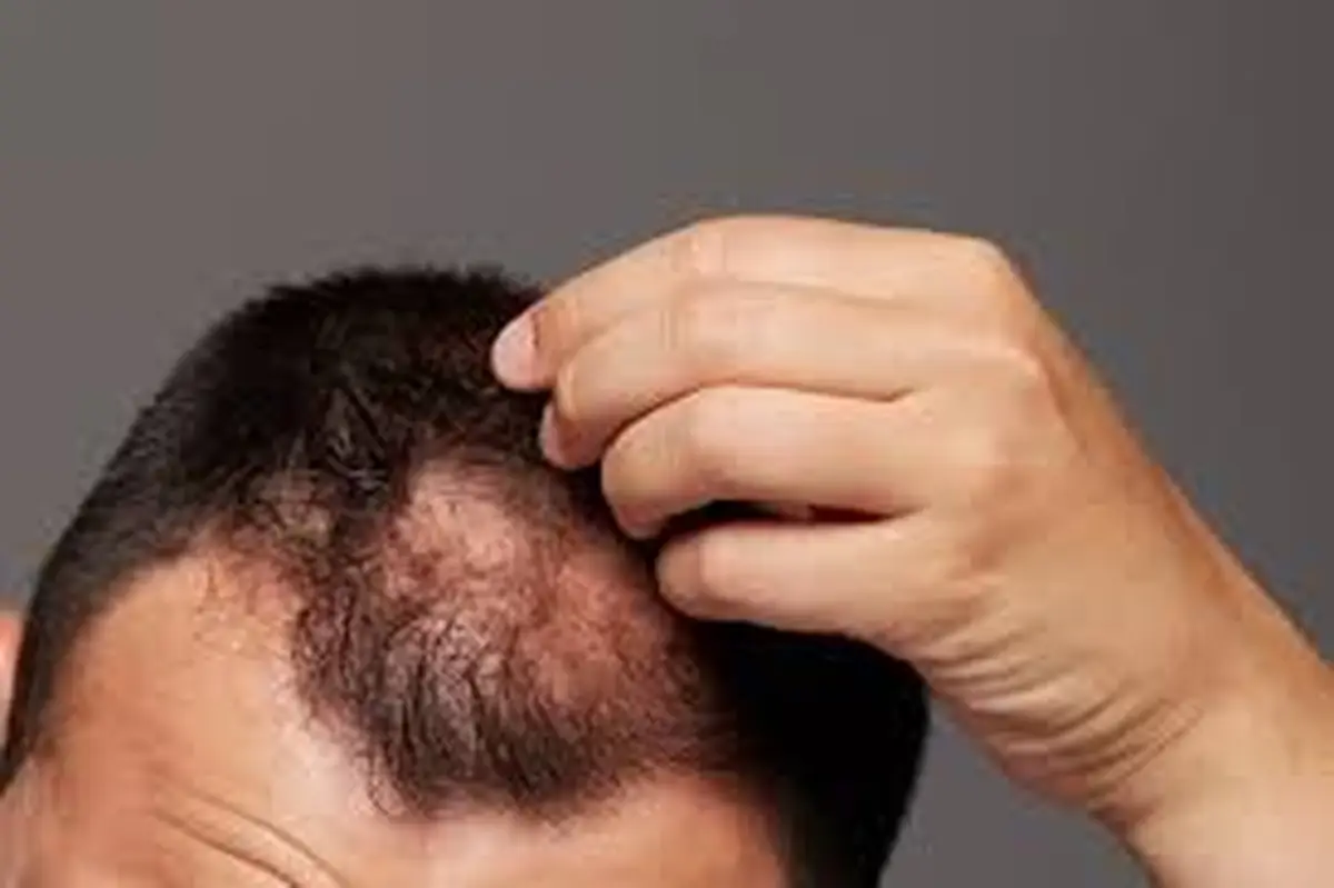 Coçando cabeça