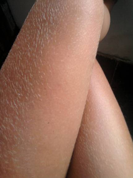 como descolorir pelos como descolorir pelos