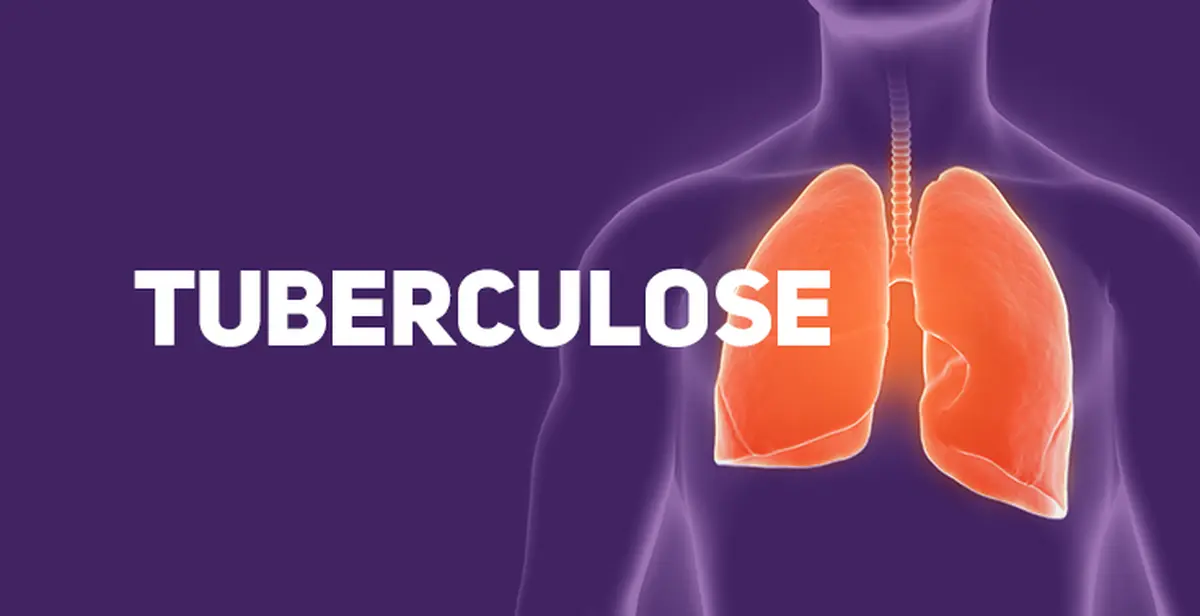 tuberculose
