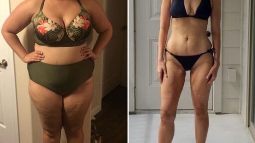 Mulher regime de 500 Calorias